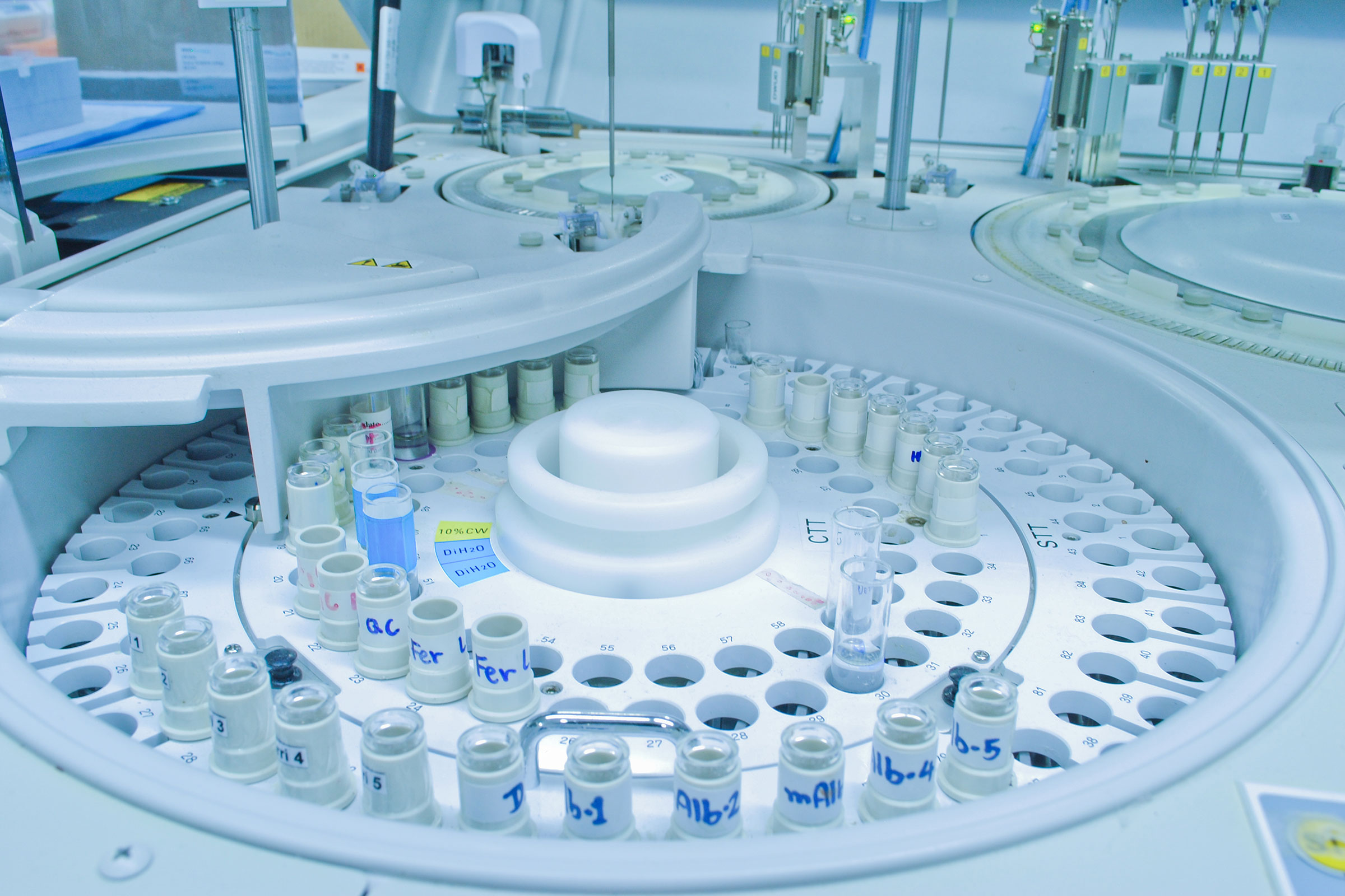 cirQum-audits-pruefeinrichtungen Runder Probenteller eines Analysengeräts im klinischen Labor, dessen Steckplätze teilweise mit Probenröhrchen besetzt sind; die Probenröhrchen sind handschriftlich mit Abkürzungen beschriftet.