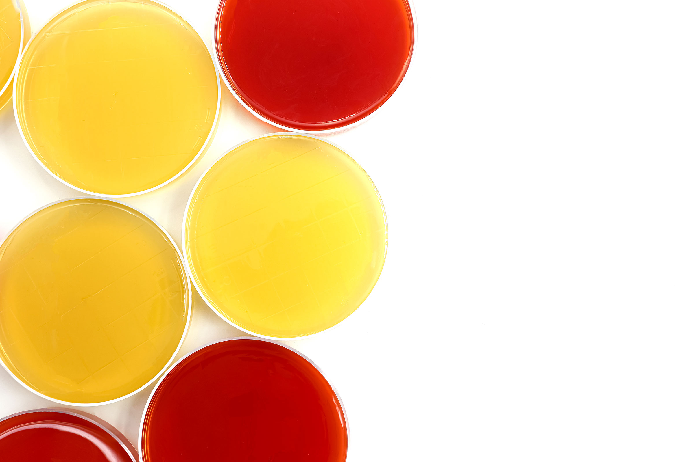 cirQum-schulungen-mikrobiologische-qualitaetskontrolle Petrischalen mit gelb und rot gefärbten mikrobiologischen Nährmedien.